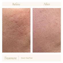 Load image into Gallery viewer, Green Sea Peel Prep &amp; Aftercare
